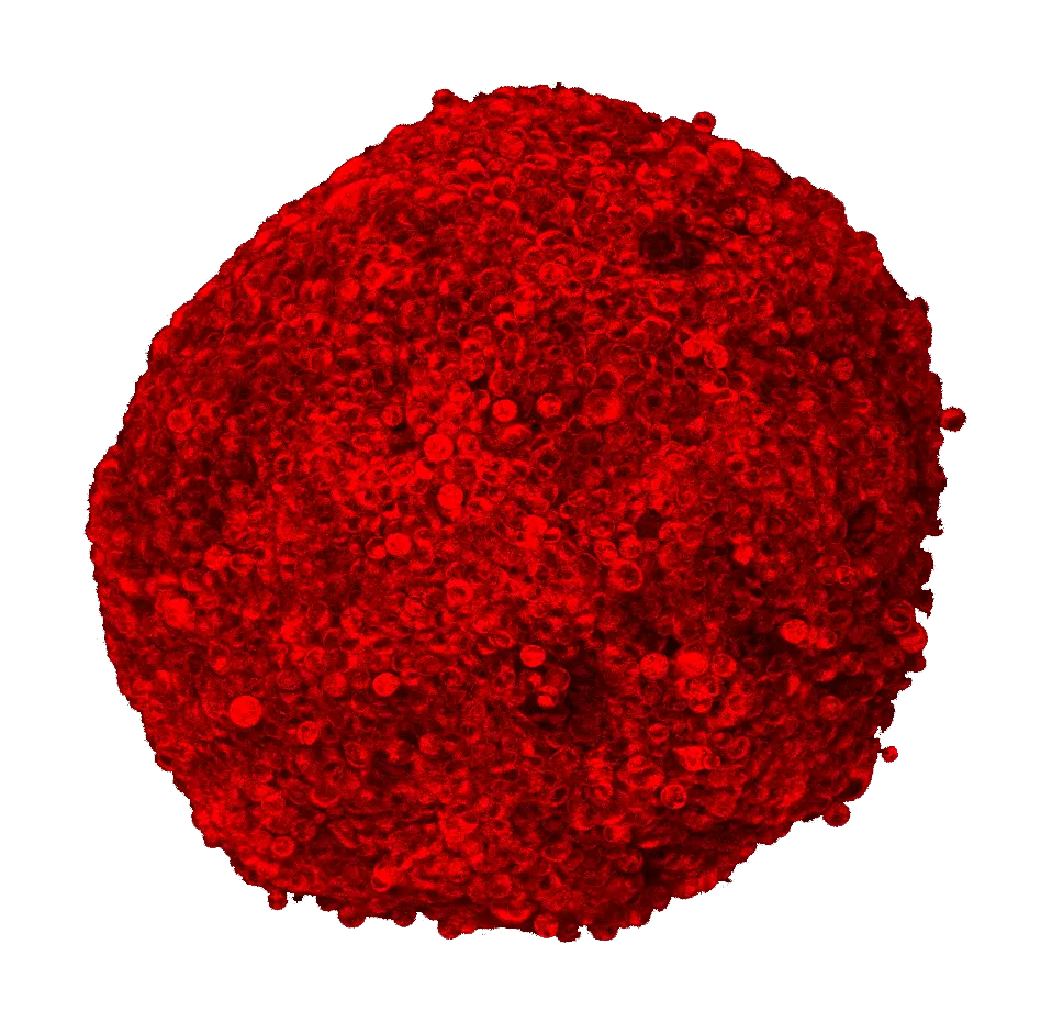 image illustrant la pénétration de phéophorbide (PDT) dans un sphéroïde tumoral de la thématique "Matière molle pour la vectorisation de principe actif, l'ingénierie tissulaire et l'imagerie" de l'équipe IDeAS - Interfaces Dynamiques et Assemblages Stimulables ©Laure Gibot