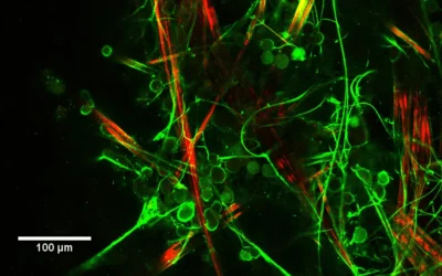 Une nouvelle molécule gélifiante pour la culture de neurones en 3D